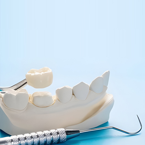 Dental Crowns services